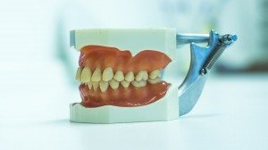 Parodontologische Zahnreinigung | Zahnarzt in Aachen Dr. med. dent. Christian Selle